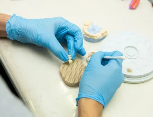 Prótesis dentales removibles: Todo lo que debes saber