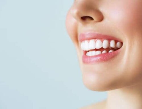 ¿Cuál es el precio del blanqueamiento dental en 2025?