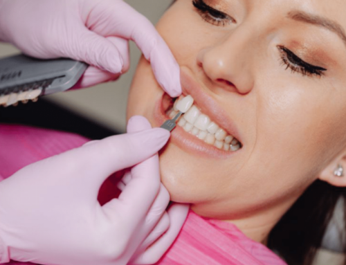 ¿Cuál es el precio de las carillas dentales en 2025?