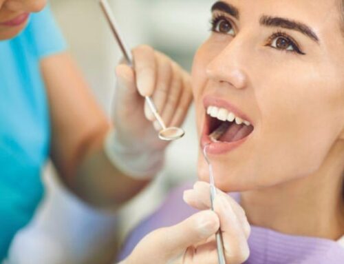 ¿Cuál es el precio de los Implantes Dentales en 2025?