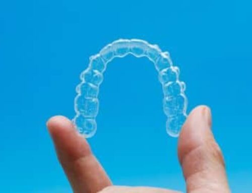 ¿Cuál es el precio de Invisalign en 2025?